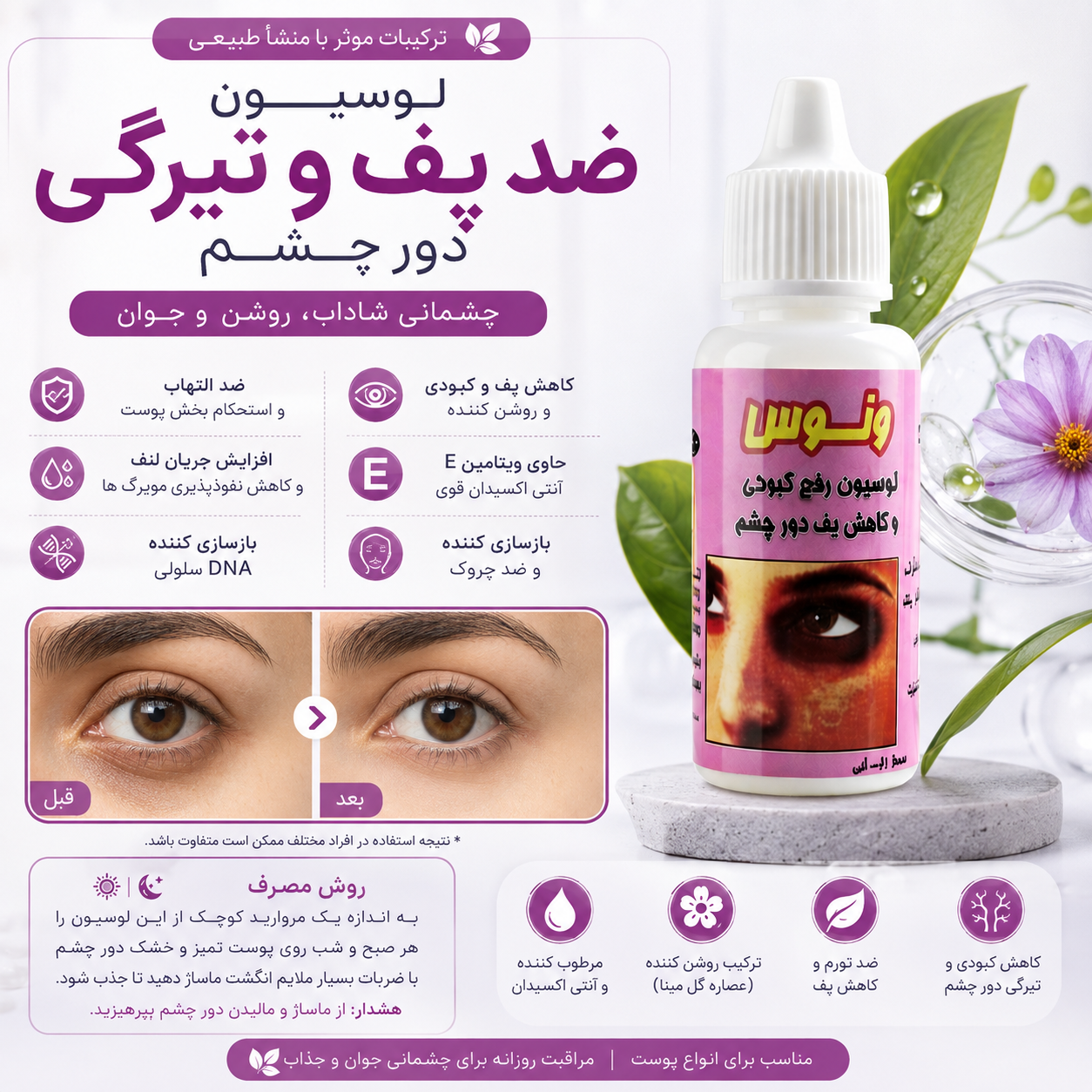 لوسیون رفع پف و تیرگی دورچشم ها