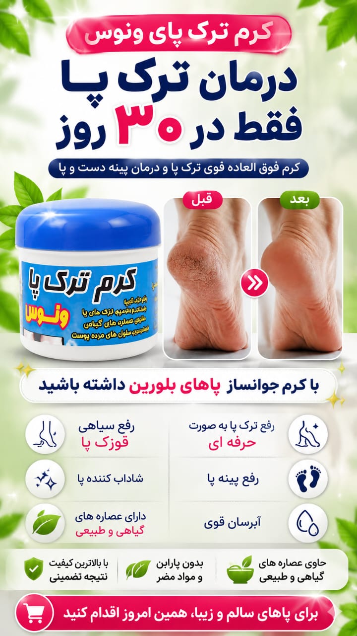 کرم ترک پاشنه پا فقط در ۳۰ روز کرم فوق العاده قوی ترک پا و درمان پینه دست و پا